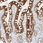 Immunohistochemical staining of human small intestine shows strong membranous positivity in glandular cells.