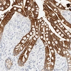 Immunohistochemical staining of human colon shows strong membranous positivity in glandular cells.
