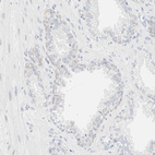 Anti-KRT20 Antibody