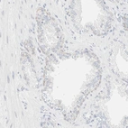 Immunohistochemical staining of human prostate shows no positivity in glandular cells as expected.