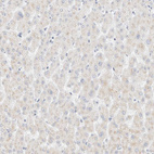 Immunohistochemical staining of human liver shows no positivity in hepatocytes as expected.