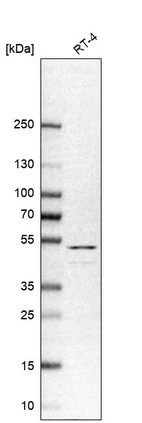 Western blot analysis in human cell line RT-4.