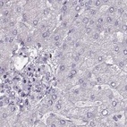Immunohistochemical staining of human liver using Anti-RP1L1 antibody HPA024686.
