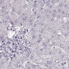 Anti-RP1L1 Antibody
