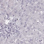 Immunohistochemical staining of human liver using Anti-RP1L1 antibody HPA024686.