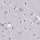 Immunohistochemical staining of human cerebral cortex using Anti-RP1L1 antibody HPA024686.