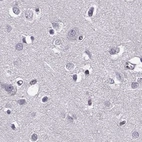 Immunohistochemical staining of human cerebral cortex using Anti-RP1L1 antibody HPA024686.