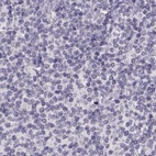 Anti-RP1L1 Antibody