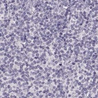 Immunohistochemical staining of human lymph node using Anti-RP1L1 antibody HPA024686.