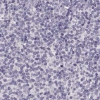 Immunohistochemical staining of human lymph node using Anti-RP1L1 antibody HPA024686.