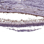 Immunohistochemical staining of human eye, retina using Anti-RP1L1 antibody HPA024686.