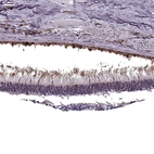 Immunohistochemical staining of human eye, retina using Anti-RP1L1 antibody HPA024686.
