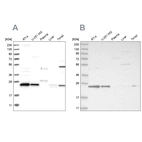Western blot analysis using Anti-VPS28 antibody HPA024688 (A) shows similar pattern to independent antibody HPA024745 (B).