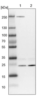 Lane 1: NIH-3T3 cell lysate (Mouse embryonic fibroblast cells)_br/_Lane 2: NBT-II cell lysate (Rat Wistar bladder tumour cells)