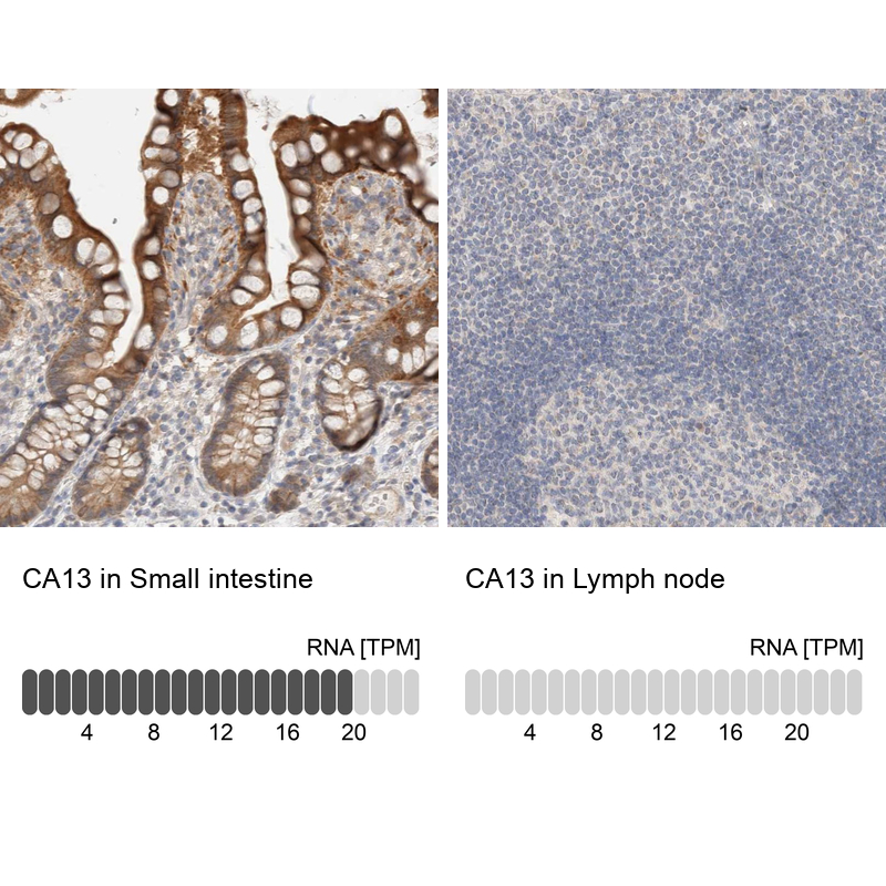 Anti-CA13 Antibody