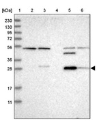 Lane 1: Marker [kDa] 230, 130, 95, 72, 56, 36, 28, 17, 11_br/_Lane 2: Human cell line RT-4_br/_Lane 3: Human cell line U-251MG sp_br/_Lane 4: Human plasma (IgG/HSA depleted)_br/_Lane 5: Human liver tissue_br/_Lane 6: Human tonsil tissue