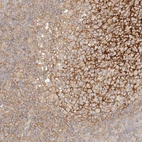 Anti-RABEP1 Antibody