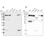 Western blot analysis using Anti-RABEP1 antibody HPA024691 (A) shows similar pattern to independent antibody HPA019669 (B).