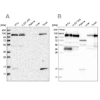 Western blot analysis using Anti-RABEP1 antibody HPA024691 (A) shows similar pattern to independent antibody HPA019669 (B).