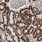 Immunohistochemical staining of human kidney show strong cytoplasmic granular positivity in cells in proximal tubules.