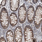 Immunohistochemical staining of human colon shows strong cytoplasmic granular positivity in glandular cells.