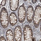 Immunohistochemical staining of human colon shows strong cytoplasmic granular positivity in glandular cells.