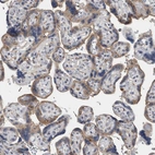 Immunohistochemical staining of human placenta shows moderate cytoplasmic granular positivity in trophoblastic cells.