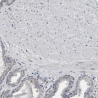 Anti-ACSF2 Antibody