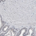 Immunohistochemical staining of human prostate shows no positivity in smooth muscle cells as expected.