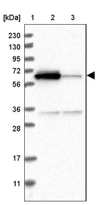 Lane 1: Marker [kDa] 230, 130, 95, 72, 56, 36, 28, 17, 11_br/_Lane 2: Human cell line RT-4_br/_Lane 3: Human cell line U-251MG sp