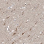 Immunohistochemical staining of human cerebral cortex shows high expression.