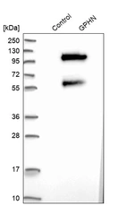 Western blot analysis in control (vector only transfected HEK293T lysate) and GPHN over-expression lysate (Co-expressed with a C-terminal myc-DDK tag (~3.1 kDa) in mammalian HEK293T cells, LY402806).