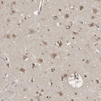 Immunohistochemical staining of human cerebral cortex shows moderate cytoplasmic positivity in neurons.