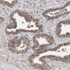 Immunohistochemical staining of human prostate shows moderate cytoplasmic positivity in glandular cells.