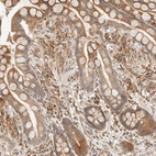 Anti-TACC1 Antibody