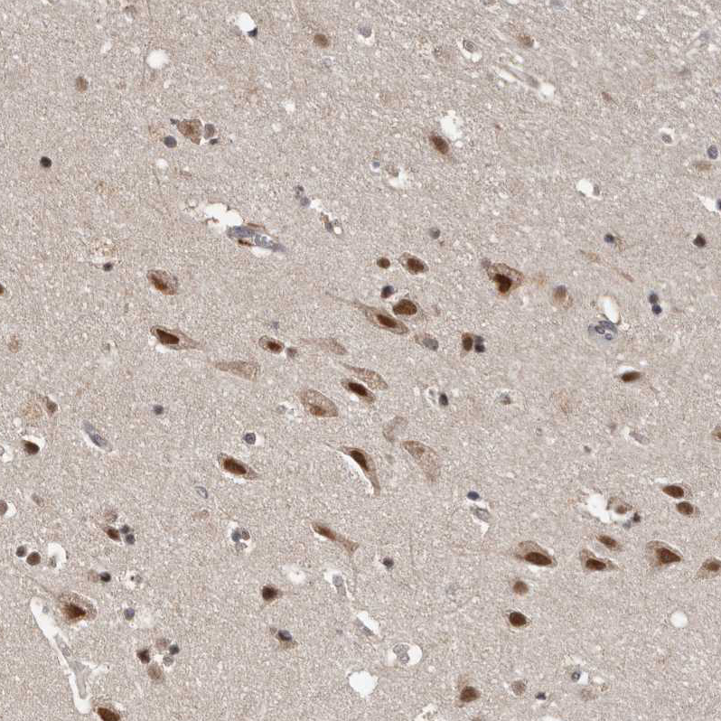 Anti-VPS37A Antibody