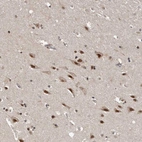 Anti-VPS37A Antibody