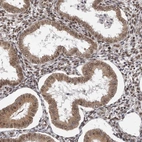 Immunohistochemical staining of human endometrium shows moderate to strong cytoplasmic positivity in glandular cells.