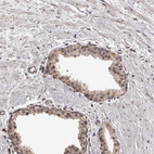 Immunohistochemical staining of human prostate shows weak to moderate cytoplasmic positivity in glandular cells.