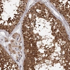 Immunohistochemical staining of human testis shows moderate to strong cytoplasmic positivity in cells in seminiferous ducts.