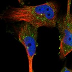 Immunofluorescent staining of human cell line U-251 MG shows localization to cytosol, centrosome & vesicles.