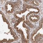 Anti-CRISPLD1 Antibody