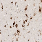 Anti-ZC2HC1A Antibody