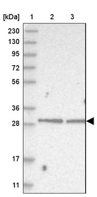 Lane 1: Marker [kDa] 230, 130, 95, 72, 56, 36, 28, 17, 11_br/_Lane 2: Human cell line RT-4_br/_Lane 3: Human cell line U-251MG sp