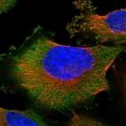 Immunofluorescent staining of human cell line U-251 MG shows localization to cytosol.