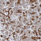 Anti-SLC28A3 Antibody