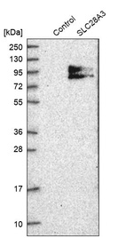 Western blot analysis in control (vector only transfected HEK293T lysate) and SLC28A3 over-expression lysate (Co-expressed with a C-terminal myc-DDK tag (~3.1 kDa) in mammalian HEK293T cells, LY402908).