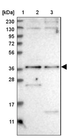 Lane 1: Marker [kDa] 230, 130, 95, 72, 56, 36, 28, 17, 11_br/_Lane 2: Human cell line RT-4_br/_Lane 3: Human cell line U-251MG sp