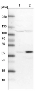 Lane 1: NIH-3T3 cell lysate (Mouse embryonic fibroblast cells)_br/_Lane 2: NBT-II cell lysate (Rat Wistar bladder tumour cells)