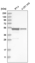 Western blot analysis in human cell line RT-4 and human cell line U-251 MG.